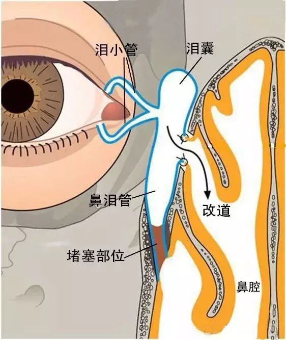 長沙市愛爾眼科成功實施鼻內鏡手術 醫院眼眶病診治技術邁上新臺階